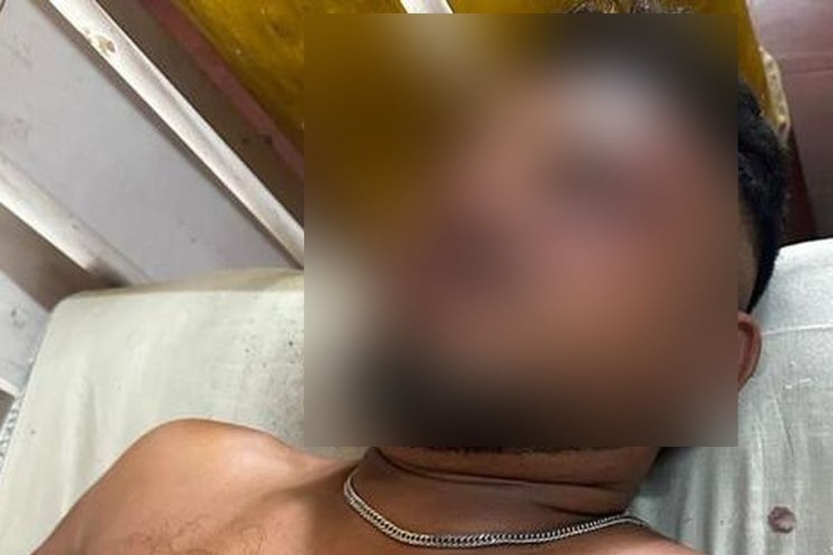 Kisah Ramesh, Satu-satunya Penumpang Selamat Kecelakaan Pesawat Air India